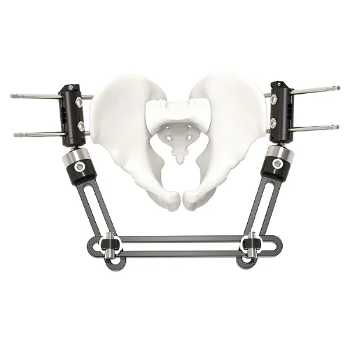 External Fixators